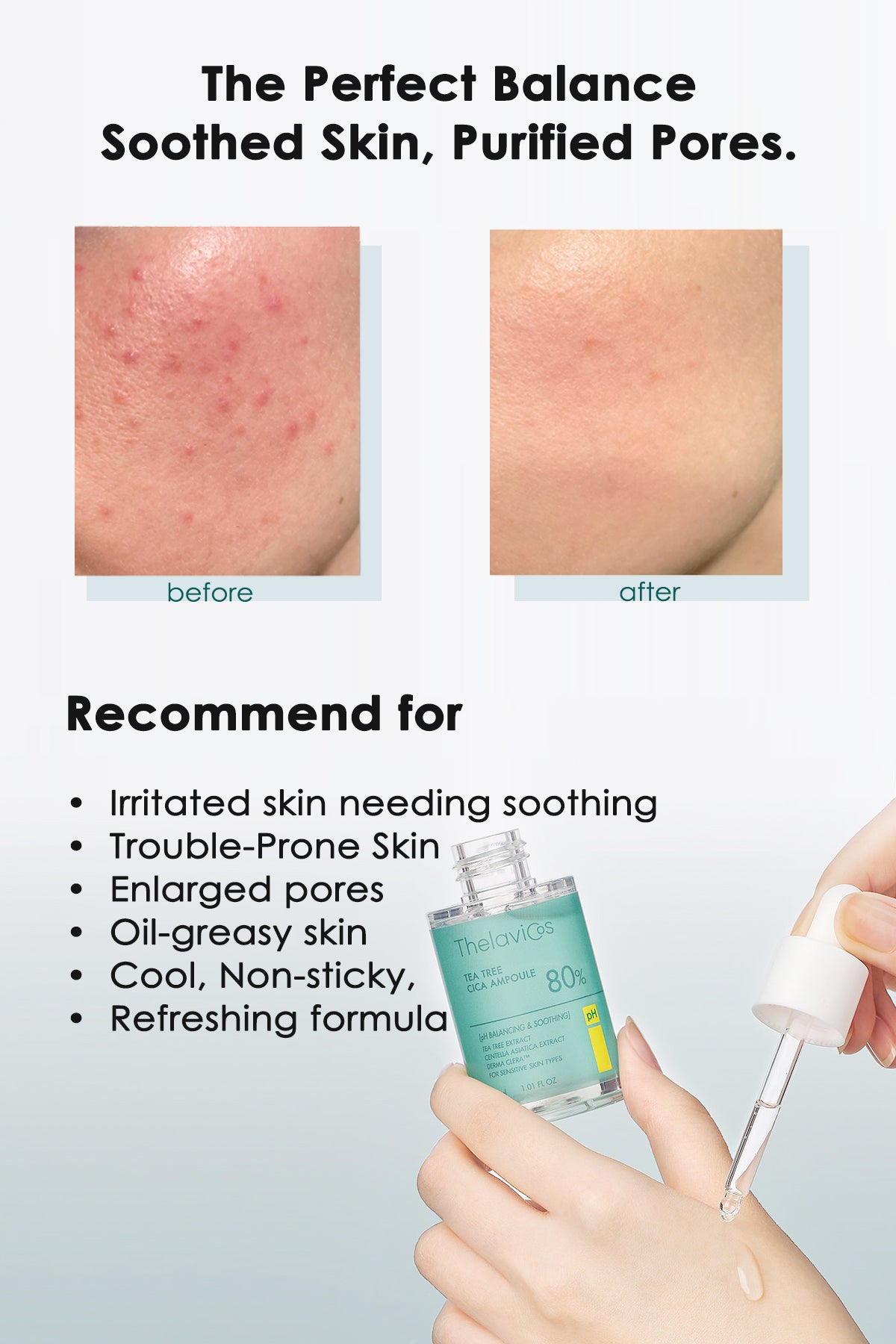 Thelavicos Tea Tree Cica 80 Ampoule 30ml/1.01 fl.oz | K-Beauty Pore Reduction, Oily Skin & Sebum Control