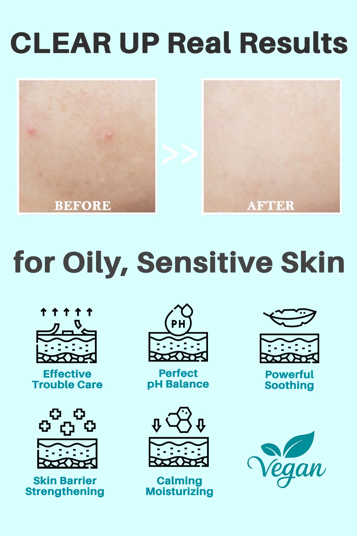 Thelavicos Tea Tree Cica Trouble pH Balanced Cleanse | Low pH Face Wash for Acne & Sensitive Skin