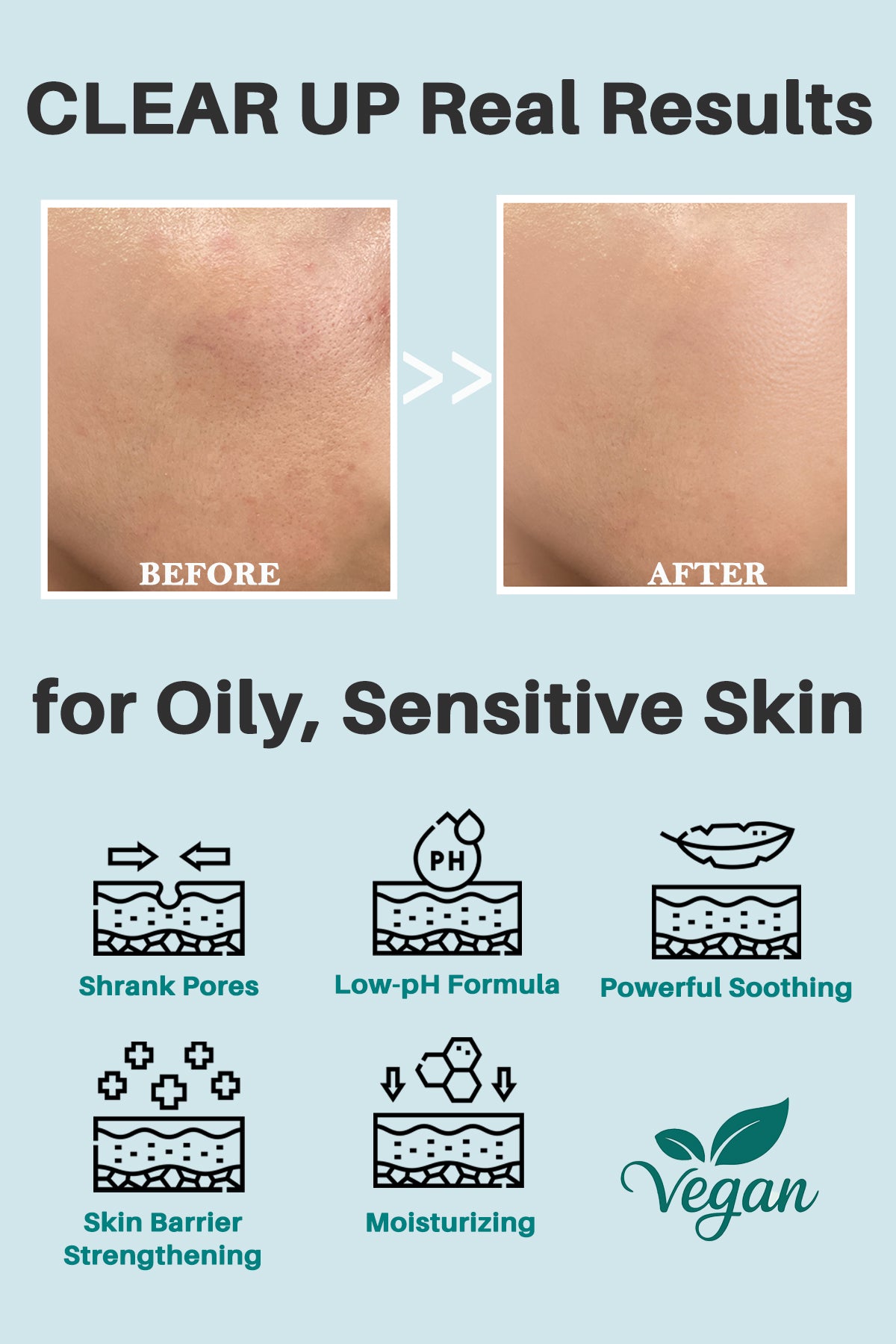 Thelavicos Tea Tree Cica 60 Moisturizer 110ml/3.71 fl.oz | Soothing for Acne, Sensitive Skin